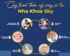 Bọc răng sứ thẩm mỹ quy trinh lam rang su