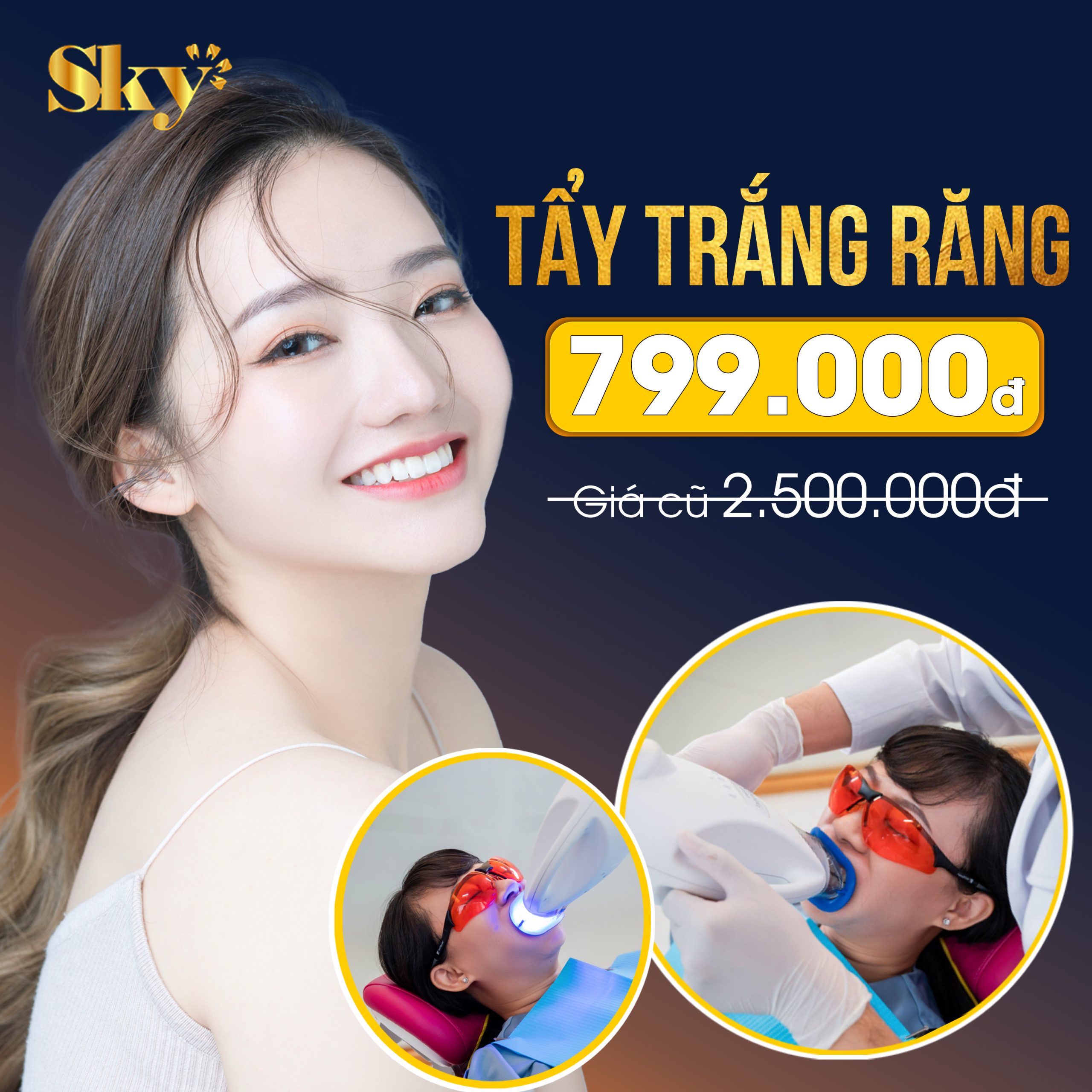 Tẩy trắng răng là gì? trang rang sky scaled