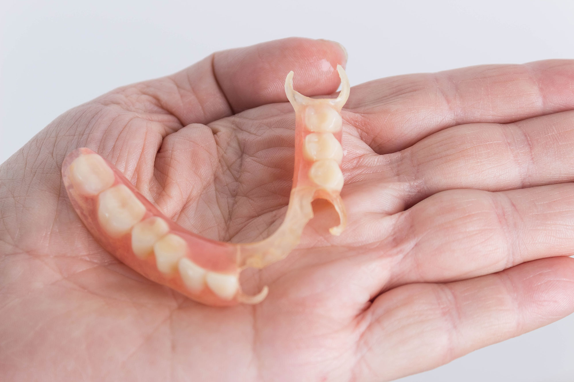 Hàm giả tháo lắp là gì? Ưu và nhược điểm của hàm tháo lắp Osteoporosis2