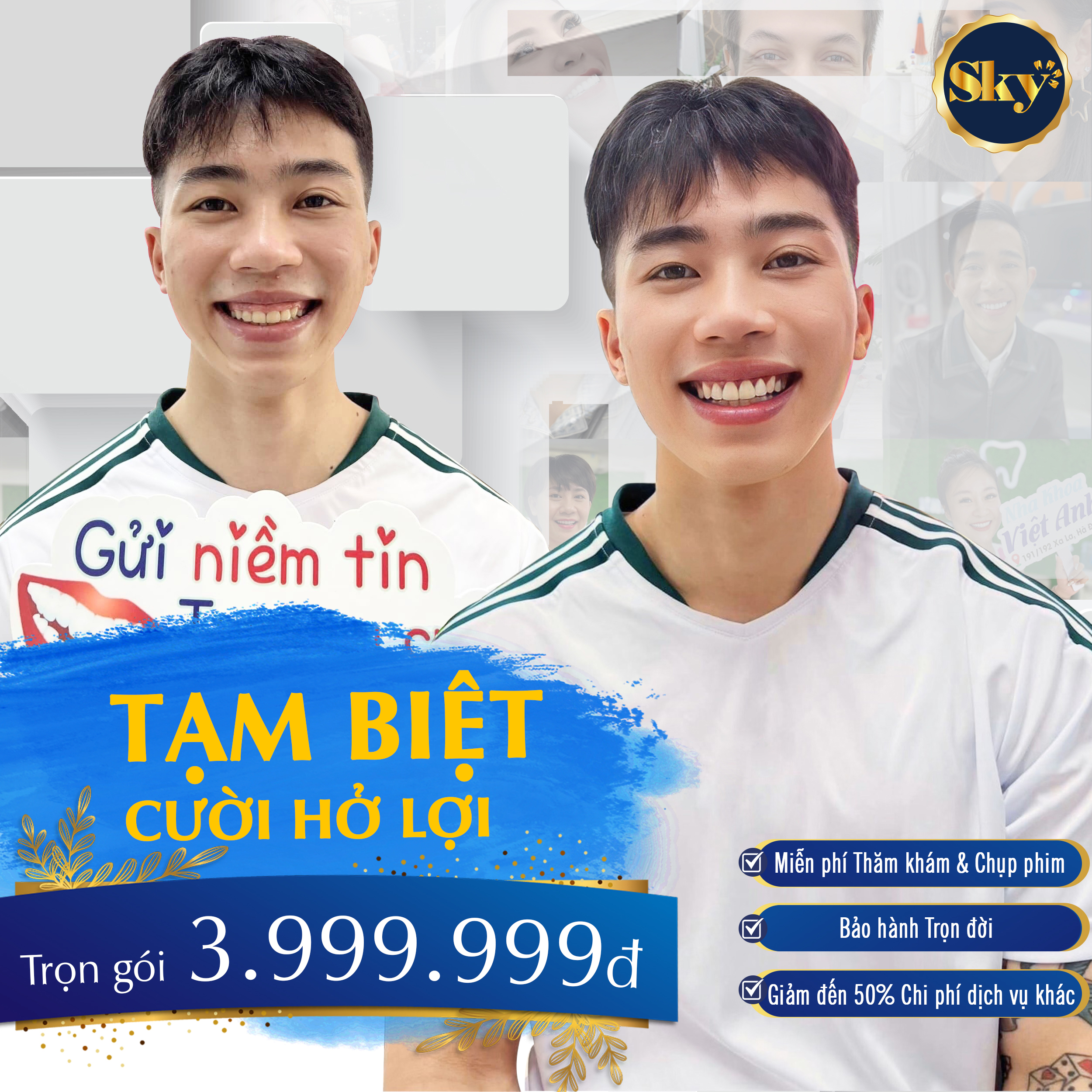 Điều trị cười hở lợi an toàn, không tái phát! Điều trị cười hở lợi